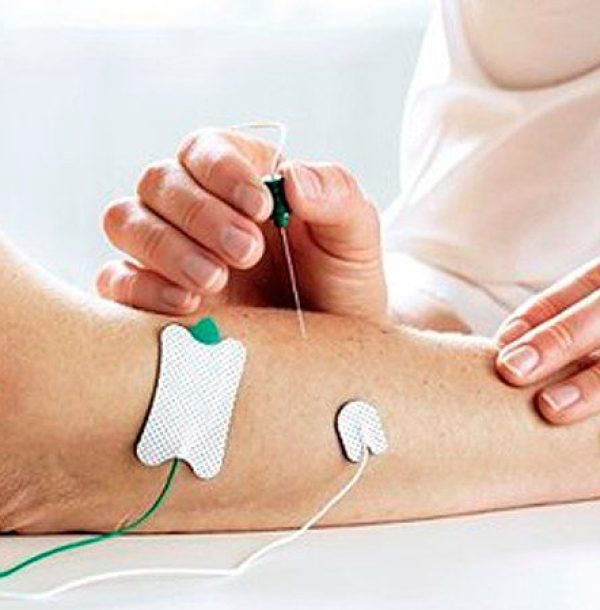 eletroneuromiografia